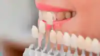 Estética Dental